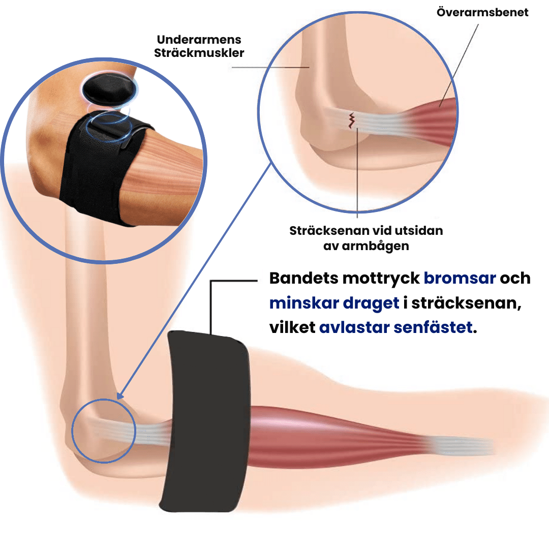 Tendura™ - Lindra din tennisarmbåge naturligt